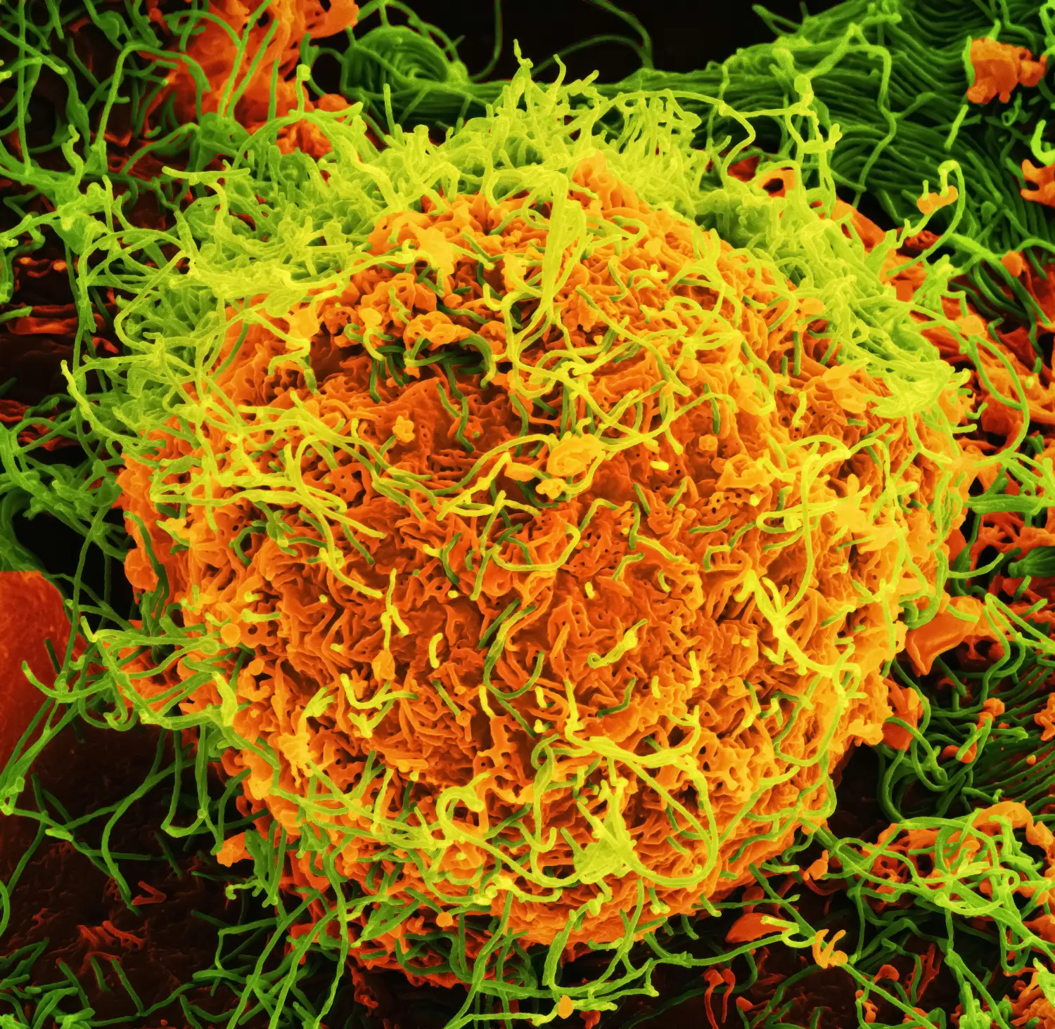 Bloodborne ebola pathogen cell